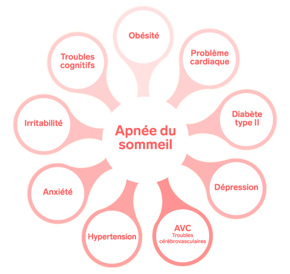 Impacts santé de l'apnée du sommeil